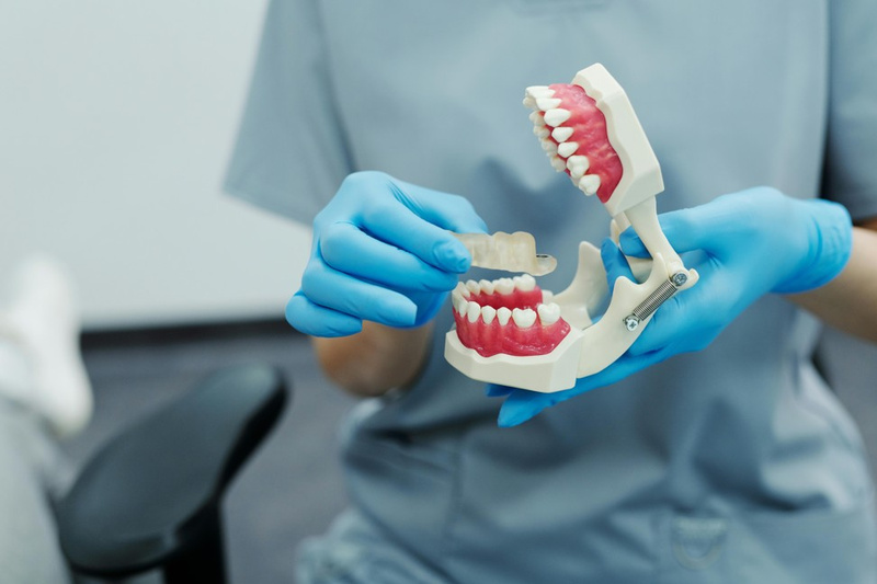 Dental Crowns 1