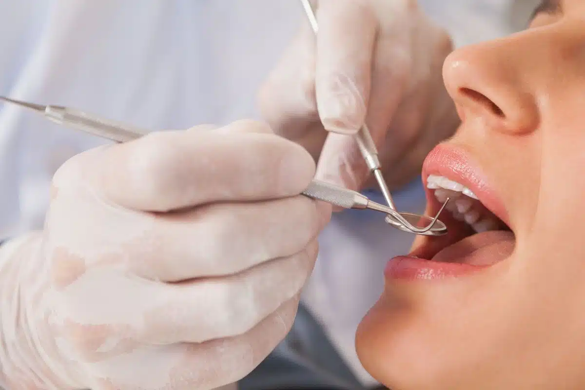 Full mouth reconstruction at Meadowvale Smiles Dental in Mississauga