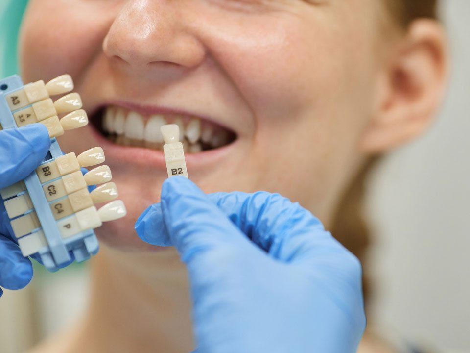Dental implant model showing the titanium post, abutment and crown