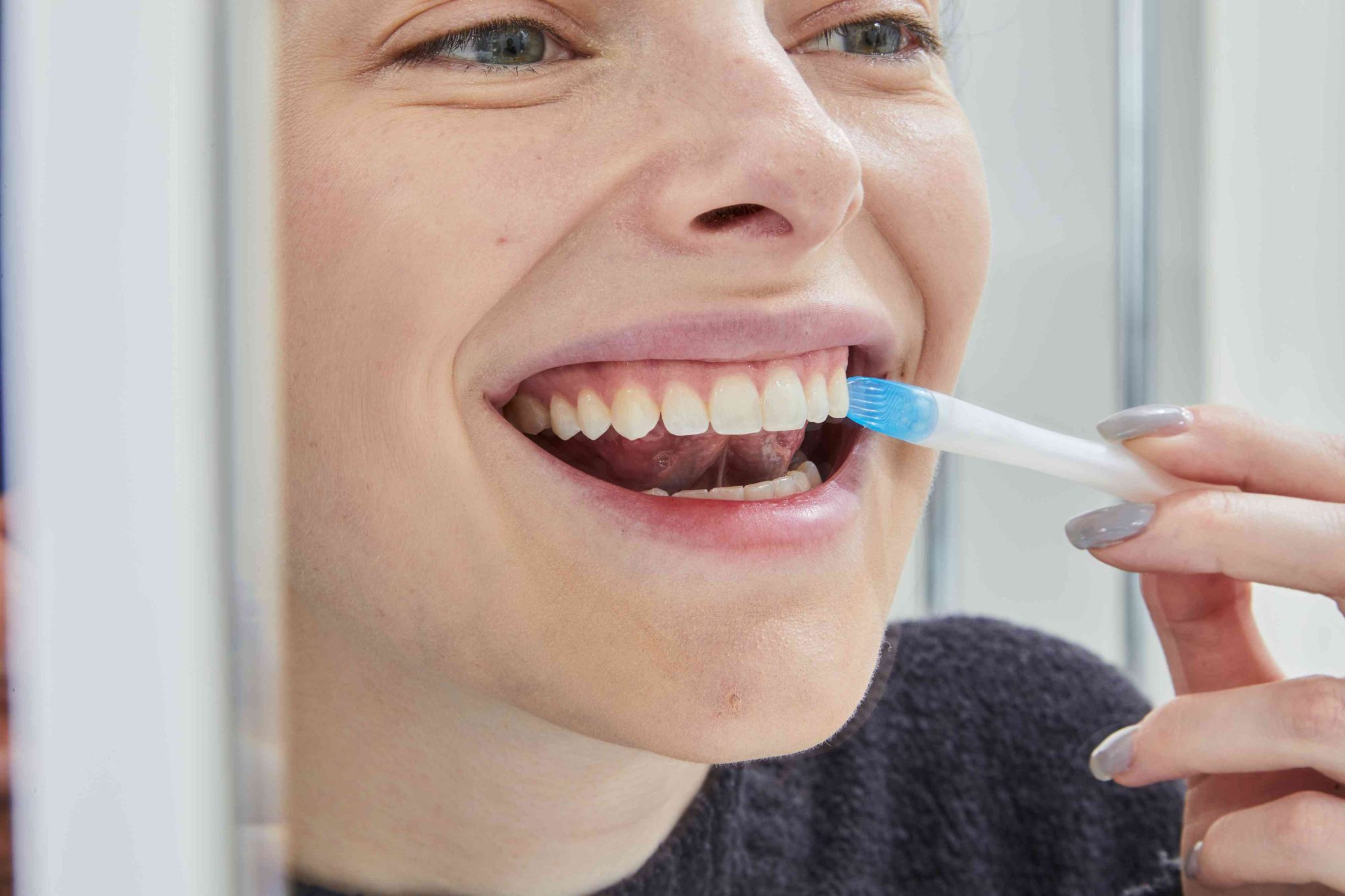 Professional teeth whitening treatment