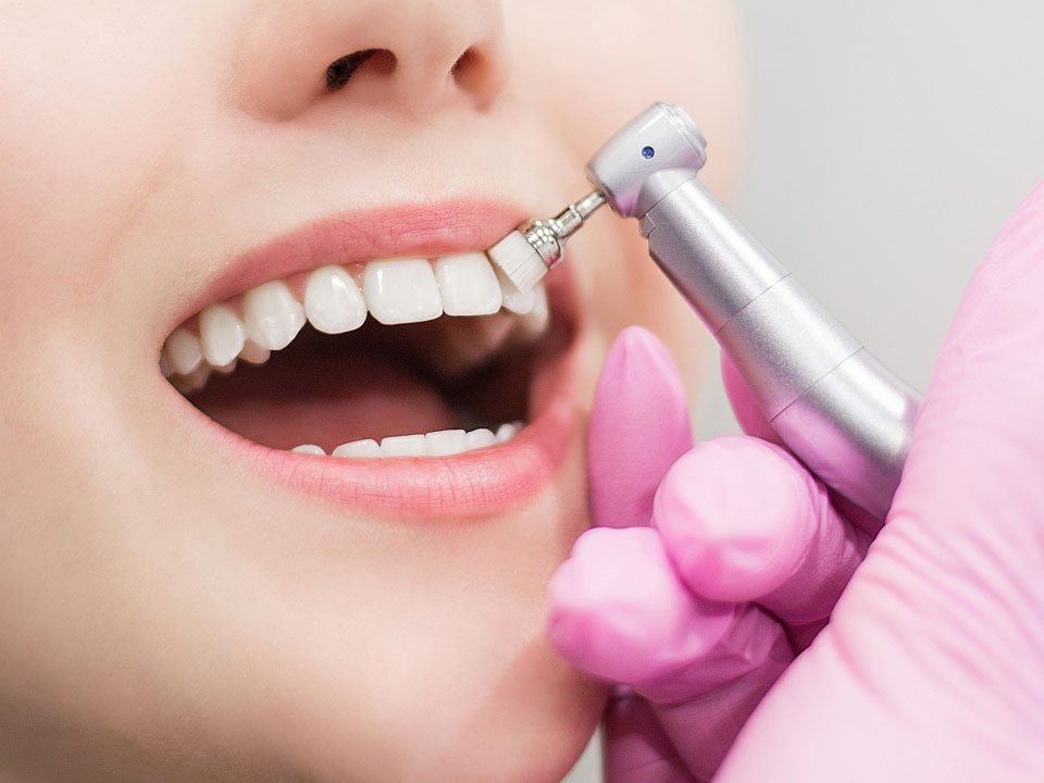 teeth-whitening
