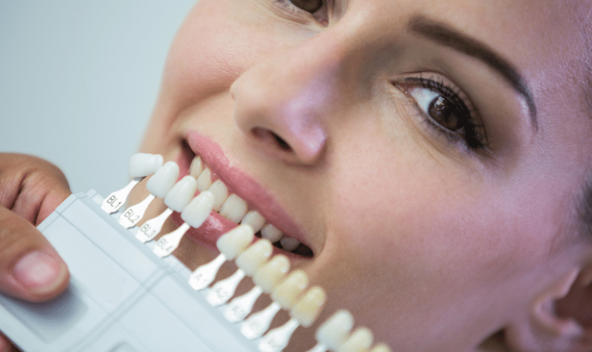 Porcelain veneers illustration